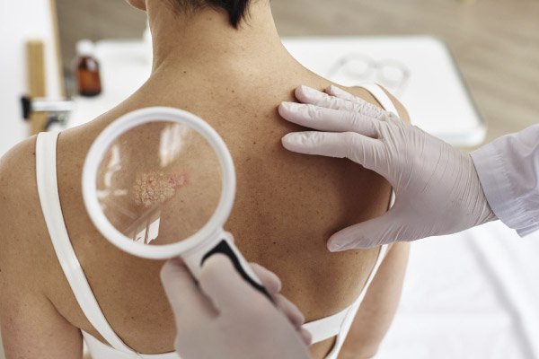 Ensayo Clínico Dermatología Celerity Clinical